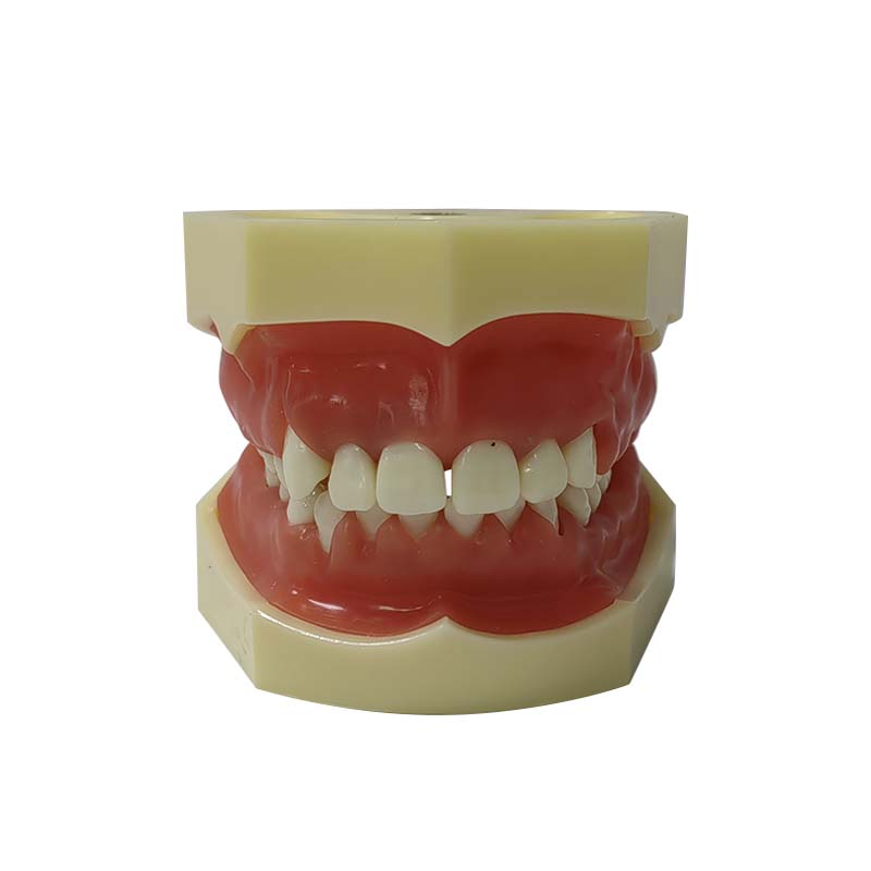 UM-4024 Periodontal Model