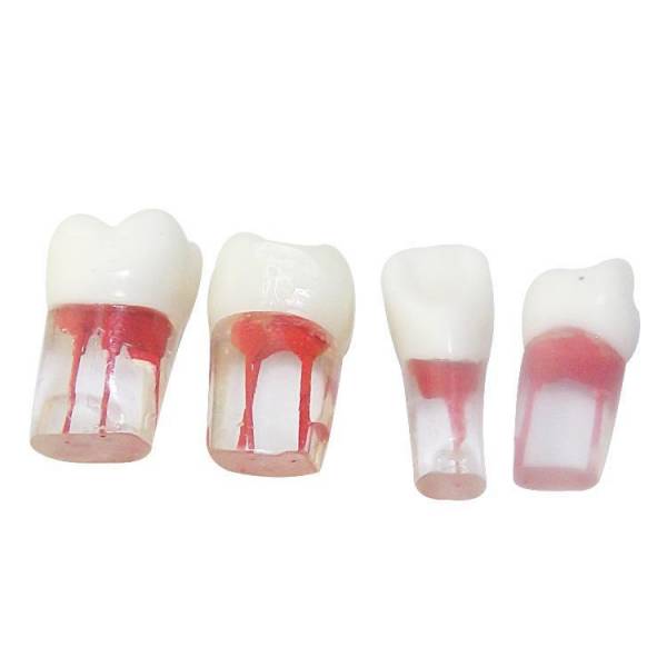 UM-LS12 Root Canal Model